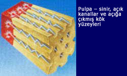 image of Pulp - the nerve center, open channels, exposed root surface
